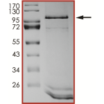 EGFR (L718Q C797S L858R), Active